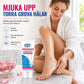 Fuktgivande urea fotkräm gel 60 ml för torra, spruckna fötter, exfolierande och återfuktande fotvård